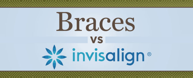 braces and clear aligners