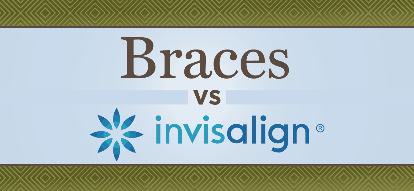 braces and clear aligners