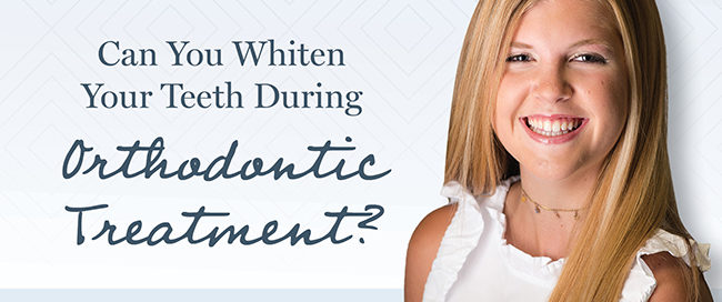 Can you whiten your teeth during orthodontic treatment