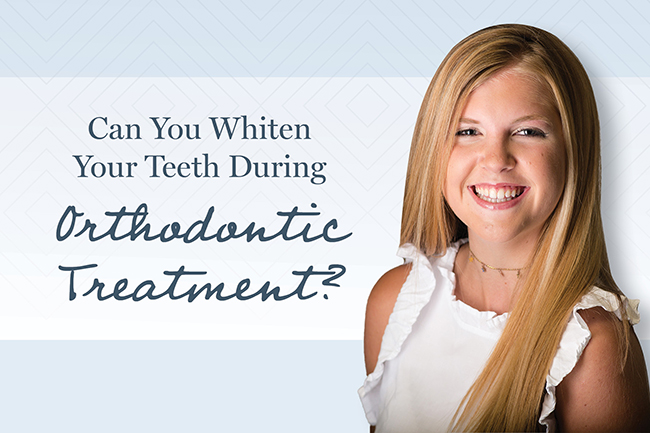 Can you whiten your teeth during orthodontic treatment