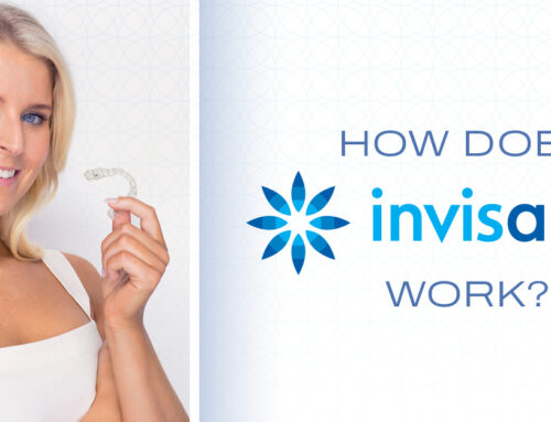 Let’s Talk About Invisalign