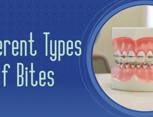 Common Bite Problems