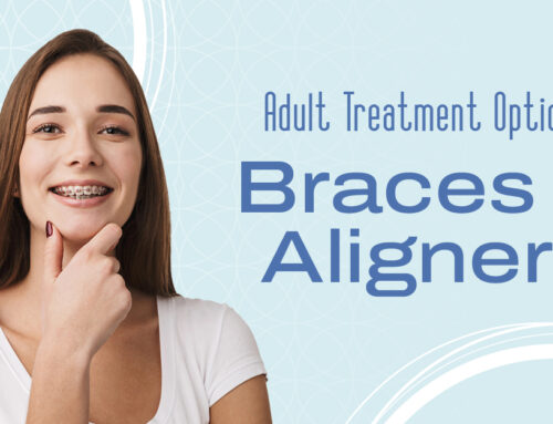 Clear Aligners for Adults