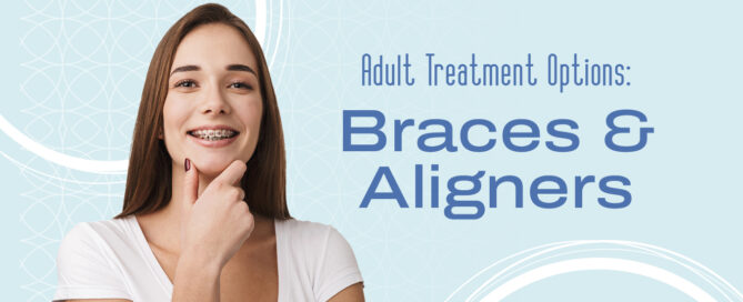 clear aligners