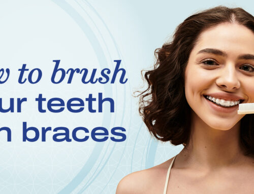 Brushing With Braces: Oral Hygiene Tips
