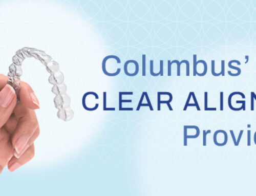 Clear Aligners in Columbus, GA: Why More Patients Are Choosing Invisalign®
