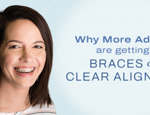 Why More Adults Are Getting Braces in Columbus, GA