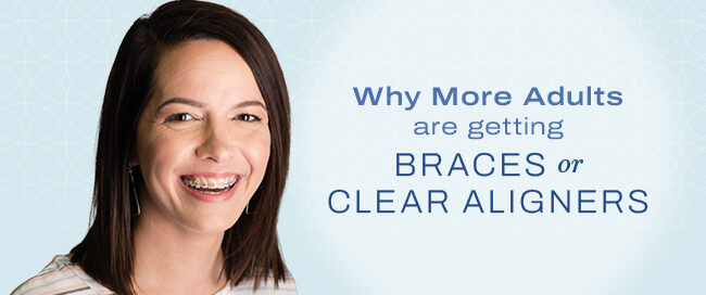 adult braces Columbus GA