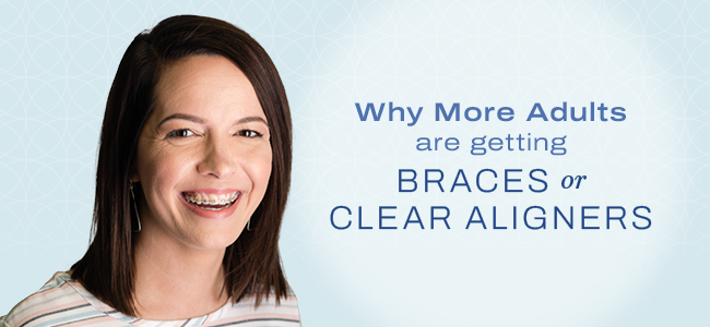 adult braces Columbus GA