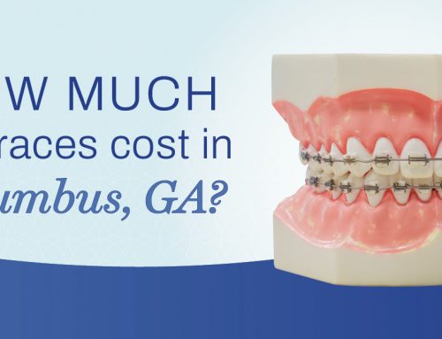 How Much Do Braces Cost in Columbus, GA?
