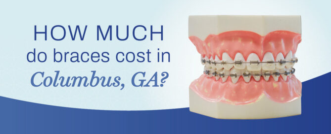 cost of braces